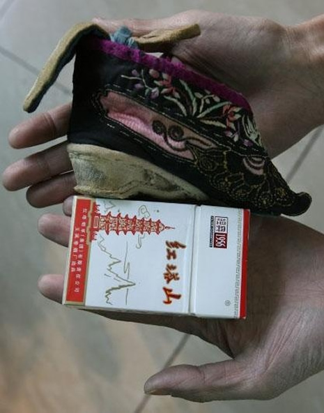 Bir geyşanın ayakları galerisi resim 11