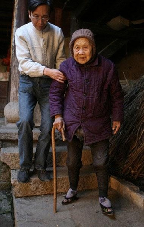 Bir geyşanın ayakları galerisi resim 8