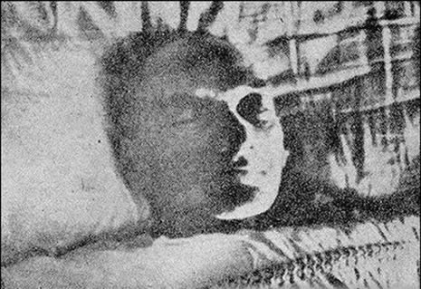 Atatürk'ün otopsi fotoğraflarının 2. bölümü galerisi resim 1