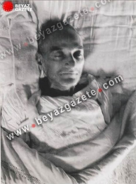 Atatürk'ün otopsi fotoğraflarının 2. bölümü galerisi resim 12