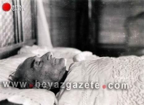 Atatürk'ün otopsi fotoğraflarının 2. bölümü galerisi resim 13