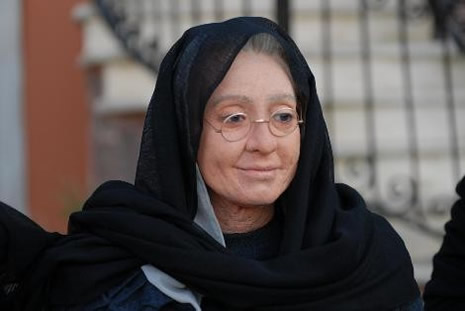 Kurt Adam'ın makyajı nasıl hazırlandı? galerisi resim 17