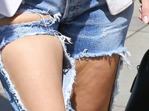 Kim Kardashian'ın bacaklarının haline bakın!