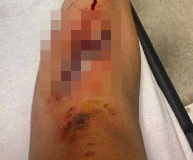 "Gözü değenin gözü çıksın" galerisi resim 3