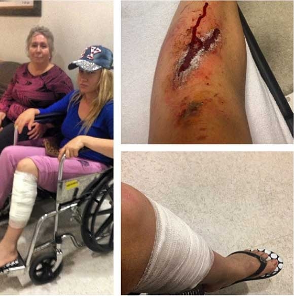 "Gözü değenin gözü çıksın" galerisi resim 5