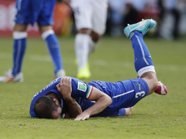 Suarez yine ısırdı galerisi resim 15