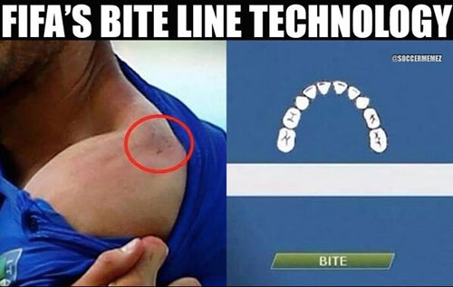 Suarez'in ısırığı sosyal medyayı salladı! galerisi resim 11