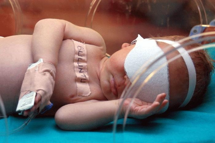 Dünyaca ünlü ödüllü fotoğraflar galerisi resim 17