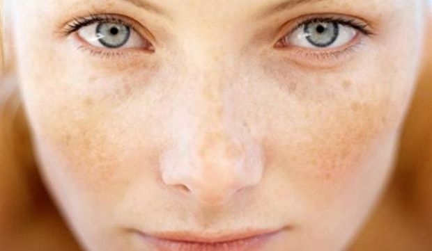 Kanser uyarısı veren 12 işaret galerisi resim 5