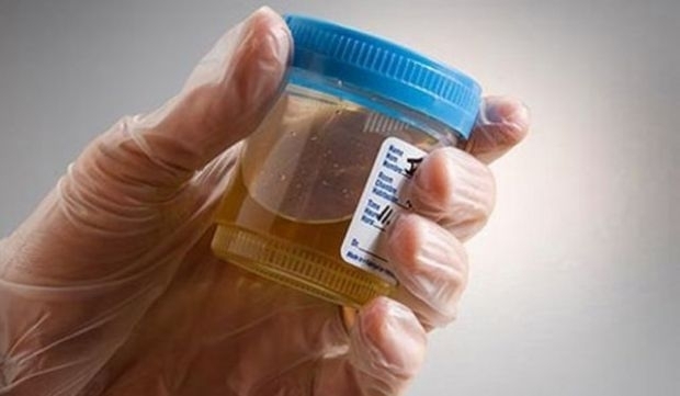 Kanser uyarısı veren 12 işaret galerisi resim 7