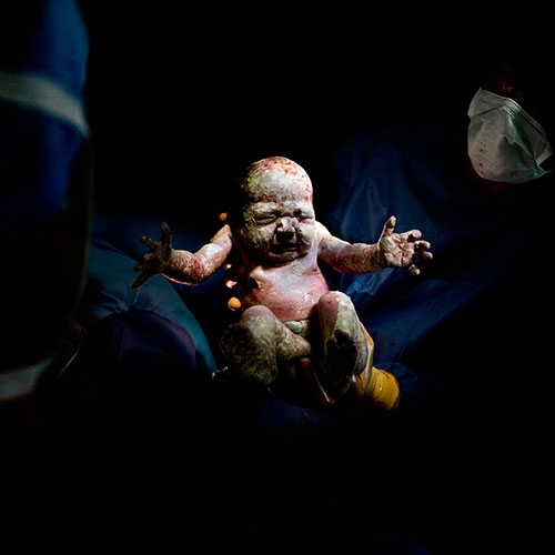 Bebeklerin dünyaya gözlerini açtıkları ilk anlar galerisi resim 8