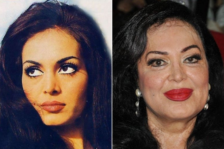 Ünlülerin yıllar sonraki değişimleri şaşkınlık yaratıyor galerisi resim 1