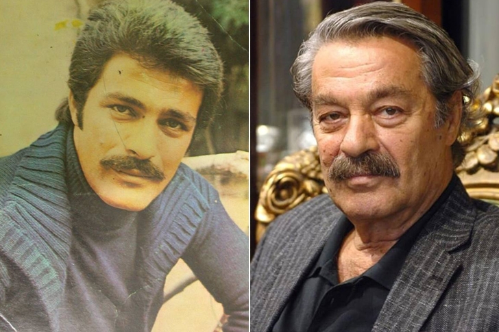 Ünlülerin yıllar sonraki değişimleri şaşkınlık yaratıyor galerisi resim 10