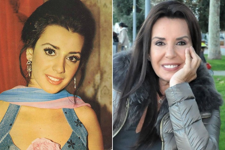 Ünlülerin yıllar sonraki değişimleri şaşkınlık yaratıyor galerisi resim 27