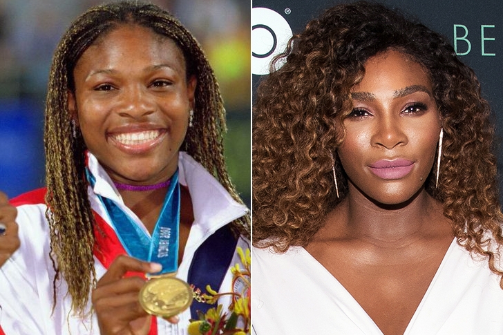 Ünlülerin yıllar sonraki değişimleri şaşkınlık yaratıyor galerisi resim 49