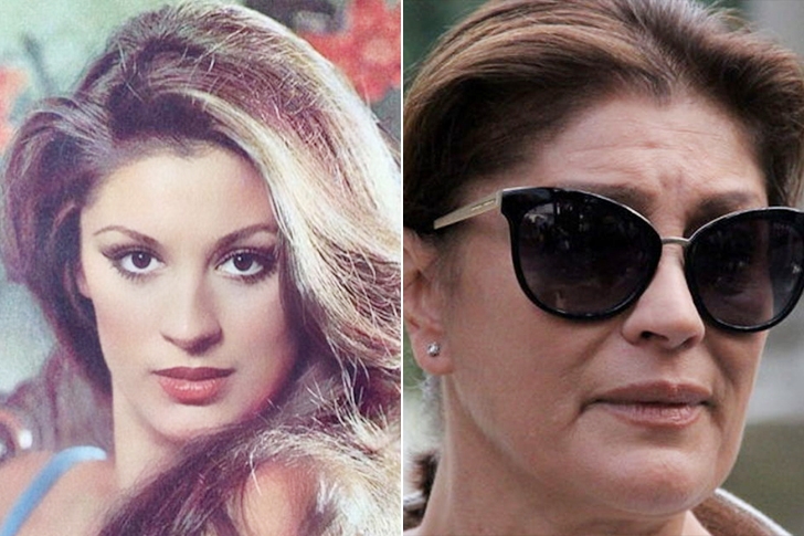 Ünlülerin yıllar sonraki değişimleri şaşkınlık yaratıyor galerisi resim 56