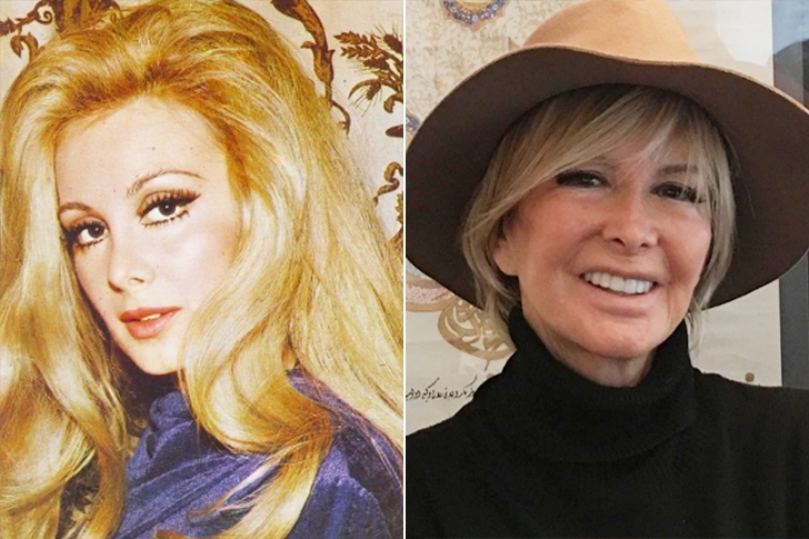 Ünlülerin yıllar sonraki değişimleri şaşkınlık yaratıyor galerisi resim 57