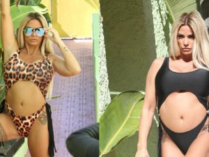 Güzelliğini Türk doktorlara borçlu!