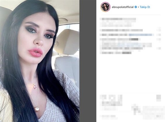 İşte ünlülerin makyajsız halleri! galerisi resim 11