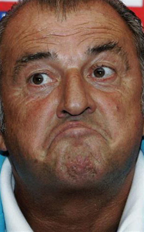 FATİH TERİM'İN İLGİNÇ HALLERİ galerisi resim 2