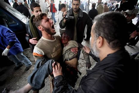 İsrail'in Gazze'deki katliamları! galerisi resim 10
