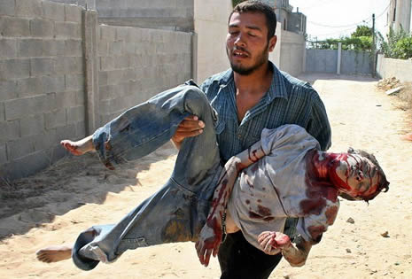 İsrail'in Gazze'deki katliamları! galerisi resim 3