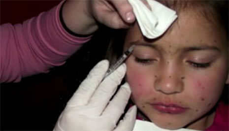 8 yaşındaki kızına botoks yaptırıyor! galerisi resim 1