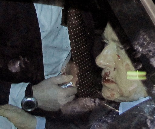 Silvio Berlusconi taburcu edildi galerisi resim 2