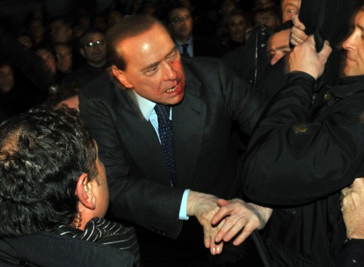 Silvio Berlusconi taburcu edildi galerisi resim 3
