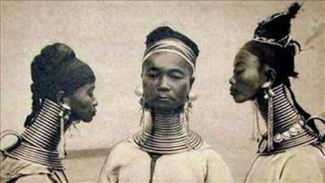 Güzellik uğruna çekilen eziyet galerisi resim 12