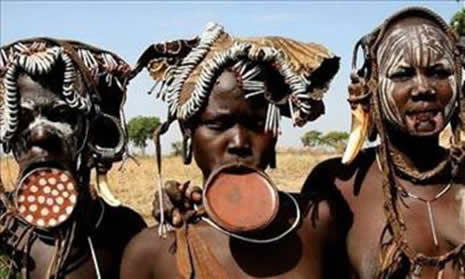 Güzellik uğruna çekilen eziyet galerisi resim 19