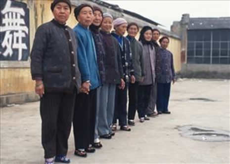 Güzellik uğruna çekilen eziyet galerisi resim 2