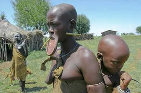 Güzellik uğruna çekilen eziyet galerisi resim 20