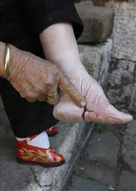 Güzellik uğruna çekilen eziyet galerisi resim 5