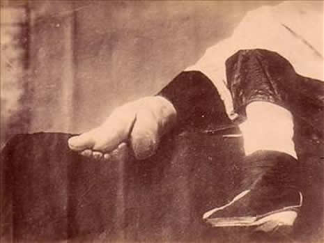 Güzellik uğruna çekilen eziyet galerisi resim 6