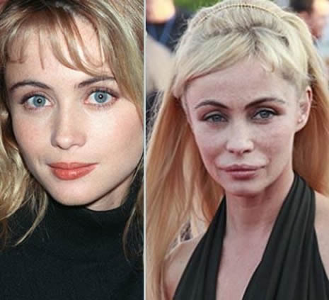 Estetik Ünlüleri Rezil Etti galerisi resim 1