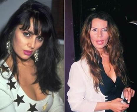 Estetik Ünlüleri Rezil Etti galerisi resim 10