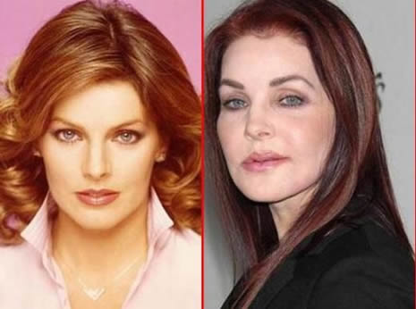 Estetik Ünlüleri Rezil Etti galerisi resim 16