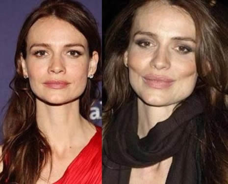 Estetik Ünlüleri Rezil Etti galerisi resim 19