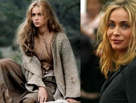 Estetik Ünlüleri Rezil Etti galerisi resim 4