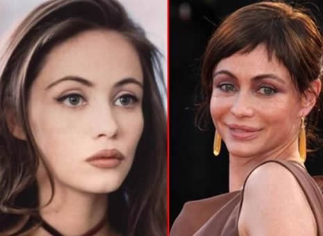 Estetik Ünlüleri Rezil Etti galerisi resim 5