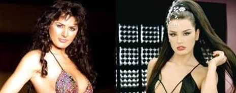 Estetik Ünlüleri Rezil Etti galerisi resim 6