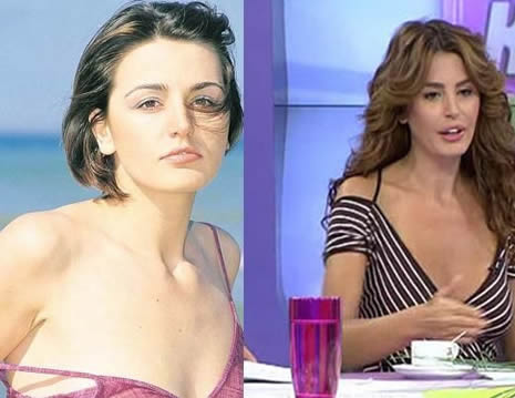 Estetik Ünlüleri Rezil Etti galerisi resim 9