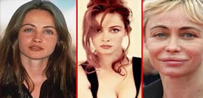 Estetik Ünlüleri Rezil Etti