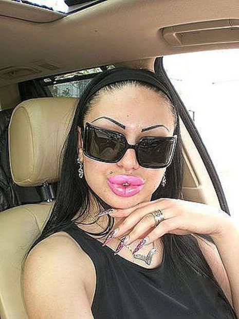 Silikonun dozunu kaçırınca galerisi resim 12