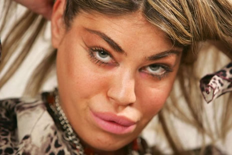 Silikonun dozunu kaçırınca galerisi resim 5