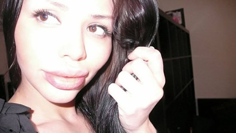 Silikonun dozunu kaçırınca galerisi resim 7