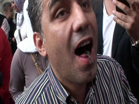 Rize'de akla zarar söylenti  galerisi resim 1