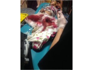 Kars’ta patos makinesine düşen kız çocuğu ağır yaralandı