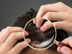 Mevsimsel saç dökülmesi nedir?